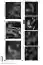 Fig. 12 - METHODS OF GENERATING NEPHRONS FROM HUMAN PLURIPOTENT STEM CELLS