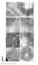 Fig. 13 - METHODS OF GENERATING NEPHRONS FROM HUMAN PLURIPOTENT STEM CELLS