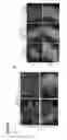 Fig. 20 - METHODS OF GENERATING NEPHRONS FROM HUMAN PLURIPOTENT STEM CELLS