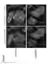 Fig. 33 - METHODS OF GENERATING NEPHRONS FROM HUMAN PLURIPOTENT STEM CELLS