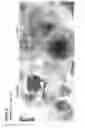 Fig. 40 - METHODS OF GENERATING NEPHRONS FROM HUMAN PLURIPOTENT STEM CELLS