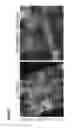 Fig. 47 - METHODS OF GENERATING NEPHRONS FROM HUMAN PLURIPOTENT STEM CELLS
