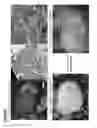 Fig. 49 - METHODS OF GENERATING NEPHRONS FROM HUMAN PLURIPOTENT STEM CELLS