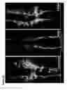 Fig. 59 - METHODS OF GENERATING NEPHRONS FROM HUMAN PLURIPOTENT STEM CELLS
