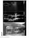 Fig. 60 - METHODS OF GENERATING NEPHRONS FROM HUMAN PLURIPOTENT STEM CELLS