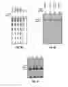 Fig. 16 - Hairpin MRNA elements and methods for the regulation of protein translation