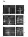Fig. 03 - Vectors with modified initiation codon for the translation of AAV-Rep78 useful for production of AAV