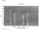 Fig. 03 - YEAST EXPRESSING CELLULASES FOR SIMULTANEOUS SACCHARIFICATION AND FERMENTATION USING CELLULOSE