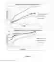 Fig. 03 - Enzymatic processes for the preparation of (±)-2-(difluoromethyl)-1-(alkoxycarbonyl)-cyclopropanecarboxylic acid and (±)-2-(vinyl)-1-(alkoxycarbonyl)-cyclopropanecarboxylic acid
