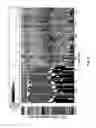 Fig. 07 - SYSTEMS AND METHOD OF ELECTROPHORETIC FRACTIONATION OF THE MICROBIOME