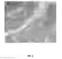 Fig. 08 - Chromogen layering for color generation