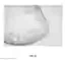 Fig. 12 - Chromogen layering for color generation