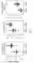 Fig. 52 - METHOD TO DETECT COLON CANCER BY MEANS OF THE MICROBIOME