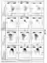 Fig. 85 - Massively parallel single cell analysis
