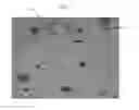 Fig. 09 - COLD GAS SPRAY COATING METHODS AND COMPOSITIONS