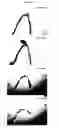 Fig. 07 - Dissolvable fibrous web structure article comprising active agents