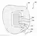 Fig. 01 - BIFUNCTIONAL FIBER FOR COMBINED SENSING AND HAPTIC FEEDBACK
