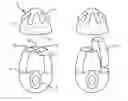 Fig. 01 - LAUNDRY PRODUCT DOSING DEVICE