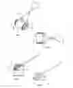 Fig. 02 - DEVICE AND METHOD FOR REMOVING OF UNWANTED MATERIAL