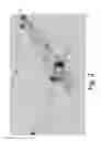 Fig. 03 - Straight line shingle
