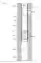 Fig. 01 - DOWNHOLE TOOL ORIENTING SUBASSEMBLY