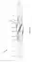 Fig. 02 - Reamer for use in drilling operations