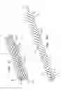 Fig. 04 - Disposable rotary flexible driveshaft and surgical cutter
