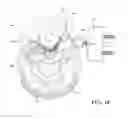 Fig. 11 - Auto return to park rotary shifter