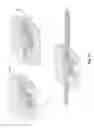Fig. 41 - APPARATUS AND METHODS FOR DISEASE DETECTION