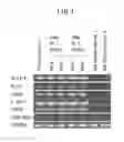 Fig. 02 - Method and kit for testing chronic myelogenous leukemia (CML), method for isolating TKI-resistant CML cells, and agent for reducing TKI-resistance of CML and method for screening the same