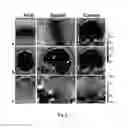 Fig. 07 - Method for dixon MRI, multi-contrast imaging and multi-parametric mapping with a single multi-echo gradient-recalled echo acquisition