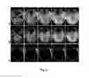 Fig. 08 - Method for dixon MRI, multi-contrast imaging and multi-parametric mapping with a single multi-echo gradient-recalled echo acquisition