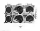 Fig. 09 - Method for dixon MRI, multi-contrast imaging and multi-parametric mapping with a single multi-echo gradient-recalled echo acquisition