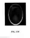 Fig. 16 - Single photon emission computed tomography imaging with a spinning parallel-slat collimator