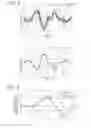 Fig. 06 - Image forming apparatus and correction of speed fluctuation of a sheet member through the image formatting apparatus