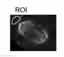 Fig. 01 - Automatically identifying regions of interest on images of biological cells