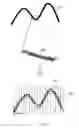 Fig. 33 - ABNORMAL WAVEFORM SENSING SYSTEM, ABNORMAL WAVEFORM SENSING METHOD, AND WAVEFORM ANALYSIS DEVICE