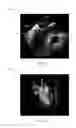 Fig. 04 - Methods and systems for model driven multi-modal medical imaging