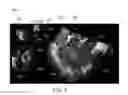 Fig. 05 - Methods and systems for model driven multi-modal medical imaging