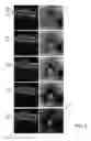 Fig. 05 - Methods for detection and enhanced visualization of pathologies in a human eye