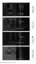 Fig. 08 - Methods for detection and enhanced visualization of pathologies in a human eye