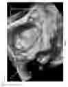 Fig. 08 - Method and system for performing real-time volume rendering to provide enhanced visualization of ultrasound images at a head mounted display
