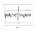 Fig. 09 - Systems and methods for detection of a target sound