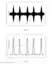 Fig. 10 - Systems and methods for detection of a target sound