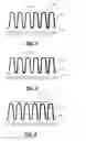 Fig. 03 - Methods for wet metal seed deposition for bottom up gapfill of features