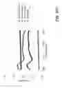 Fig. 09 - Repeaterless passive optical add/drop multiplexed fiber network