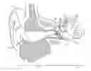 Fig. 01 - HEARING SYSTEM HAVING IMPROVED HIGH FREQUENCY RESPONSE