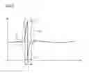 Fig. 04 - Method for detecting high-voltage flashovers in X-ray equipment and X-ray equipment
