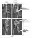 Fig. 08 - Rodent embryonic stem cell with conditional ACVR1 mutant alleles