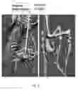 Fig. 11 - Rodent embryonic stem cell with conditional ACVR1 mutant alleles
